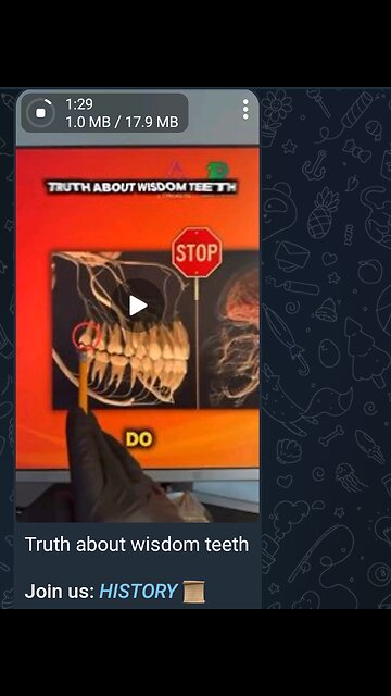 Documentary: Wisdom Teeth