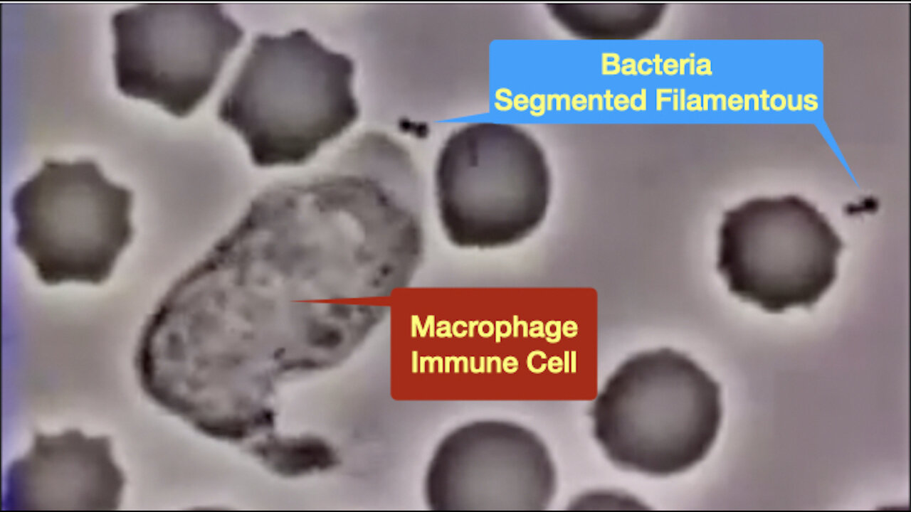 Bacteria vs. Macrophage: Unveiling the Battle Within Your Immune System