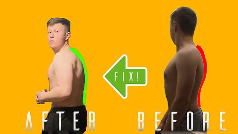 Ultimate Guide to FIX Your Hunch Back!