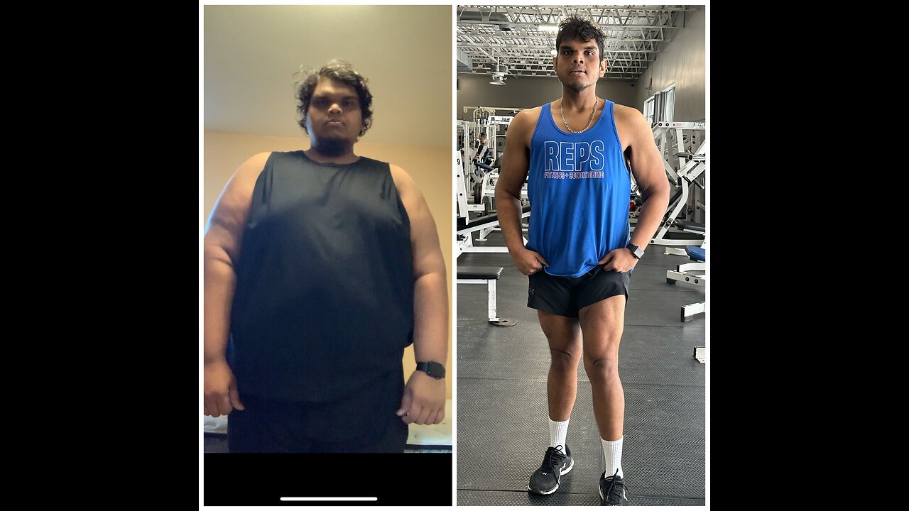 My 170 pounds weight loss transformation