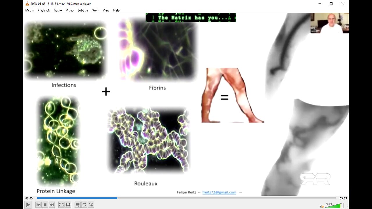 THERMOGRAPHIC IMAGING: VAXXED = DEPOPULATION