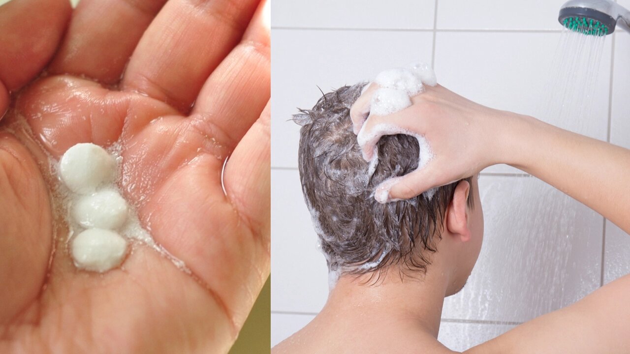 How to Get Rid of Dandruff Using Aspirin