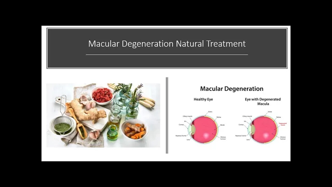 Macular Degeneration Natural Treatment