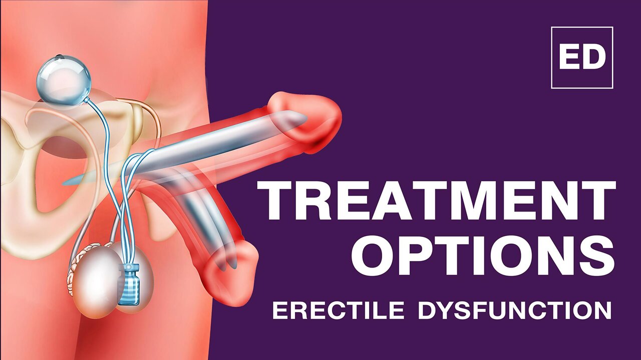 Erectile Dysfunction Treatments | How To Cure Erectile Dysfunction Permanently Without Side Effect