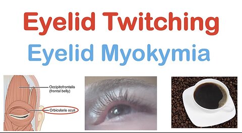 Eyelid Twitching (Eyelid Myokymia) | Triggers, Pathophysiology, Symptoms, Diagnosis, Treatment