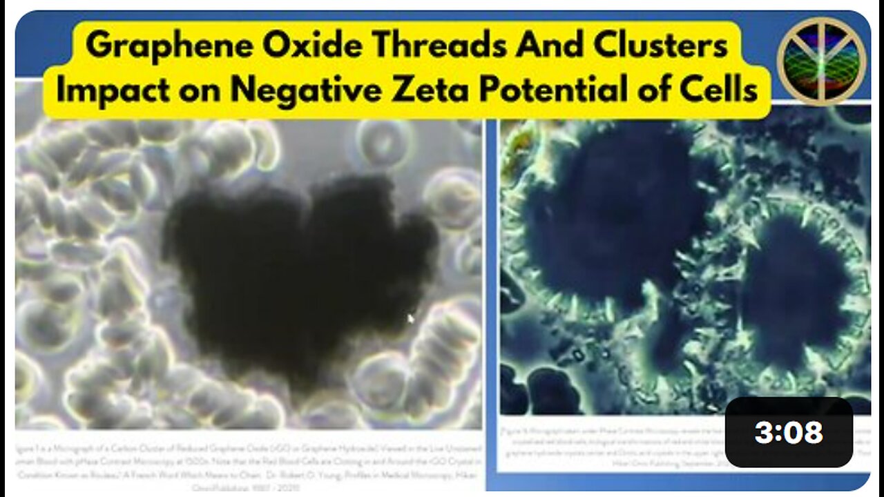 Graphene Oxide Threads And Clusters Impact on Negative Surface Charge or Zeta Potential of Blood Cells