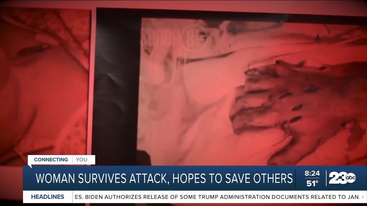 Woman survives attack, hopes to save others