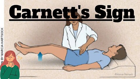 Carnett's Sign in Abdominal Examination | Clinical Insight for MBBS Students | Novice Medic