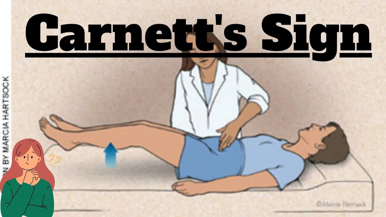 Carnett's Sign in Abdominal Examination | Clinical Insight for MBBS Students | Novice Medic