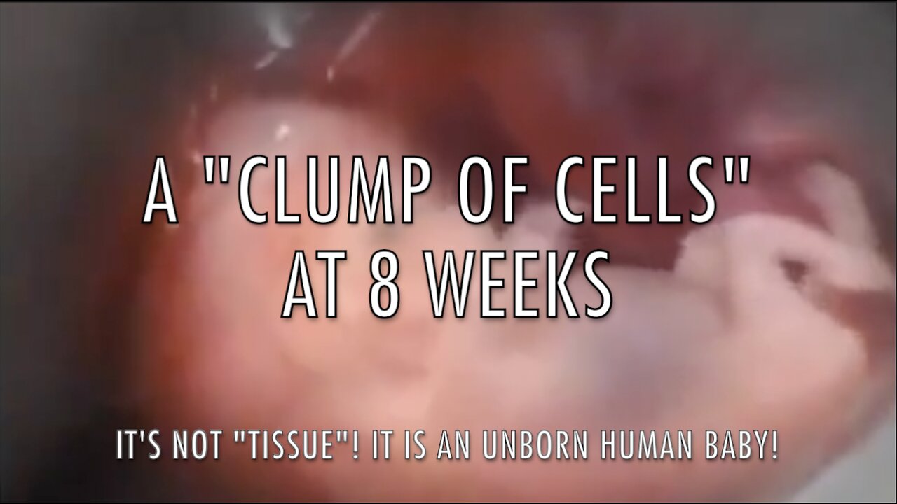 A "CLUMP OF CELLS" AT 8 WEEKS