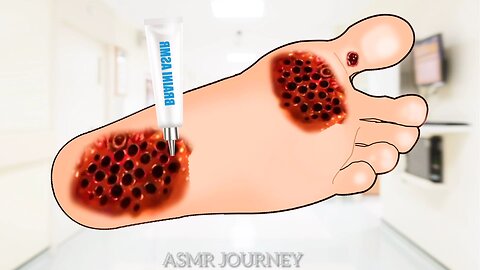 ASMR video for treating feet. Removing ticks and maggots from a dog's feet. ASMR ANIMATION #asmr