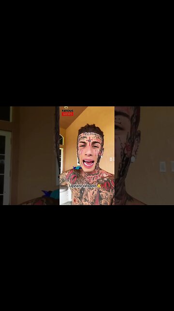 Heartfelt Update: Kodiak Red's Brave Step Towards Recovery 💪