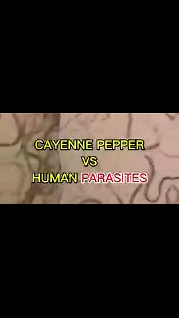CAYENNE PEPPER VS HUMAN PARASITES (UNDER THE MICROSCOPE) ⚡