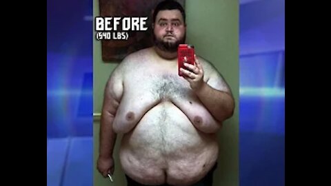 Man’s Incredible Weight Loss and Overcoming Food Addiction