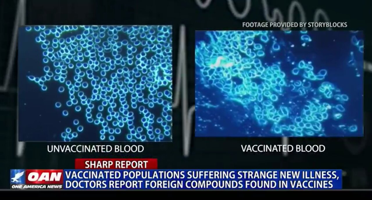 People collapsing in spasms captured worldwide on CCTV may be linked to Covid vaccine