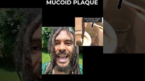 [FREE EVENT TOMORROW] Learn to Remove Mucoid Plaque and Create Godlike Immunity Eating Mucus-free