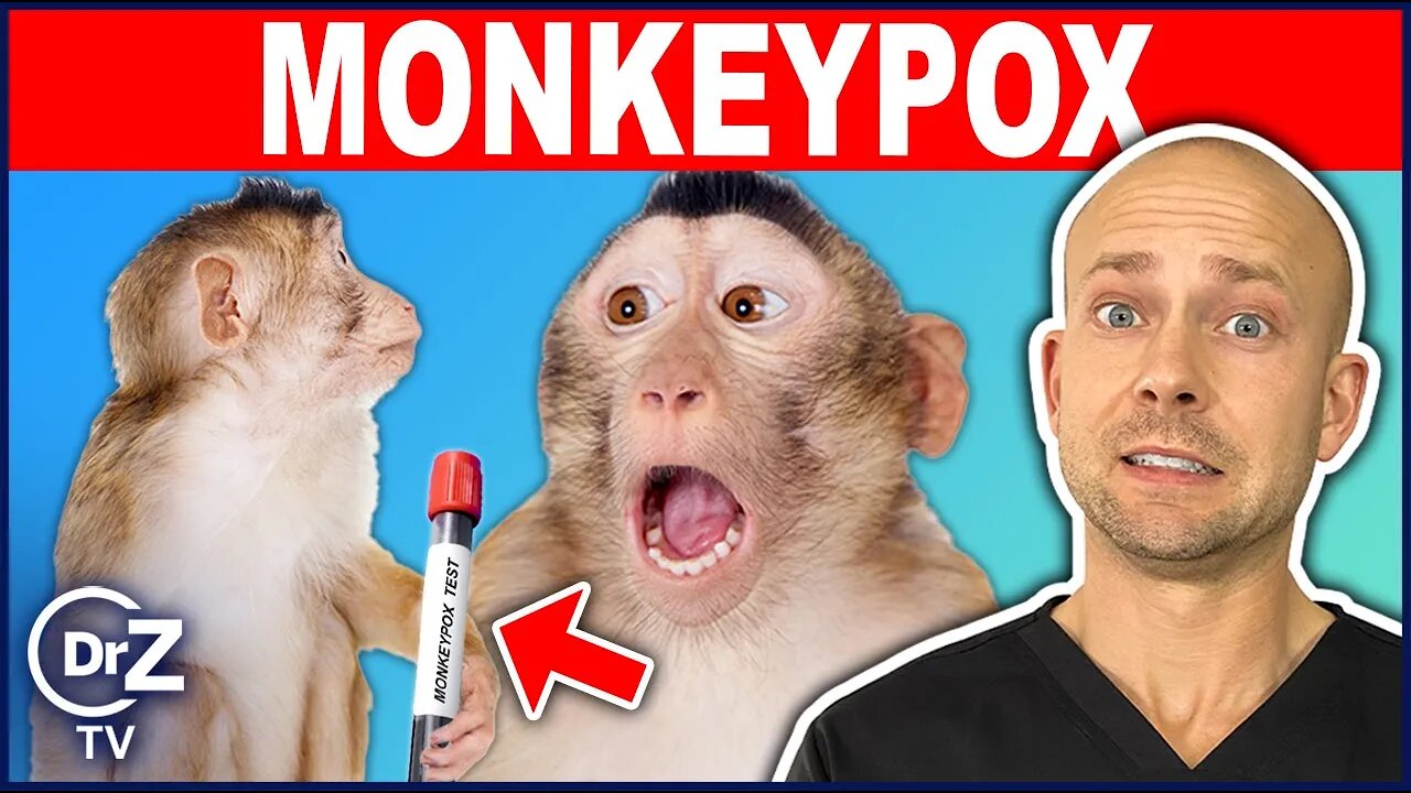 Breaking News: Is MONKEYPOX The Next Major Threat?