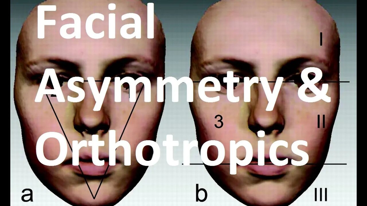 Causes, Treatment and Complications of Facial Asymmetry by Prof John Mew