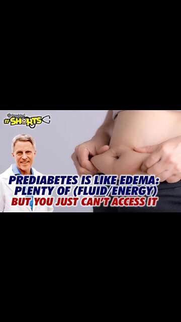 #SHORTS Prediabetes is like Edema: Plenty of (fluid/energy) - but you just can’t access it