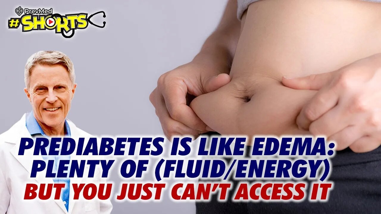 #SHORTS Prediabetes is like Edema: Plenty of (fluid/energy) - but you just can’t access it