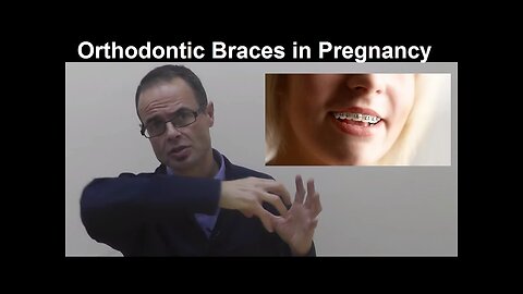 Can Pregnant Women Wear Orthodontic Braces, Brackets or Appliances by Dr Mike Mew