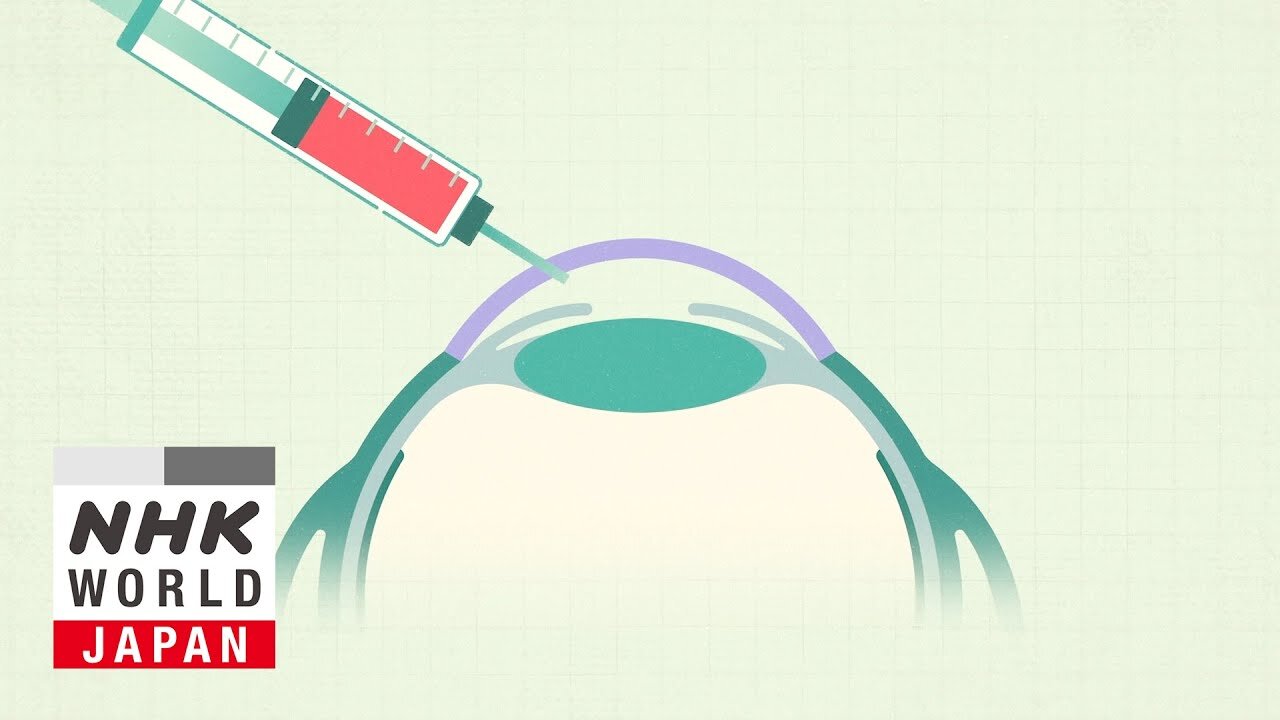 Preventing Blindness With iPS Cells - Medical Frontiers