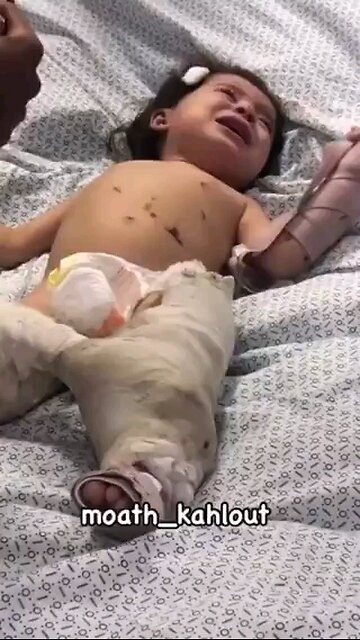 She is da sole survivor of da massacre Israel murdered ALL 15 family members including her mother⏬⏬