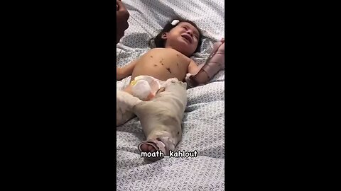 She is da sole survivor of da massacre Israel murdered ALL 15 family members including her mother⏬⏬