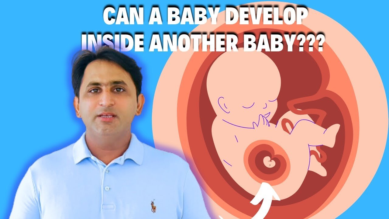 Can a Baby Develop Inside Another Baby? Possible? کیا ایک بچہ دوسرے بچے کے اندر نشوونما پا سکتا ہے؟