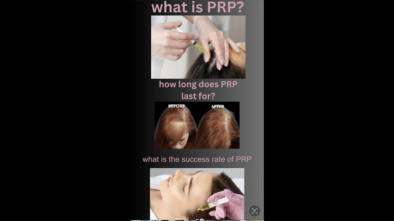 PRP TREATMENT coming soon !!