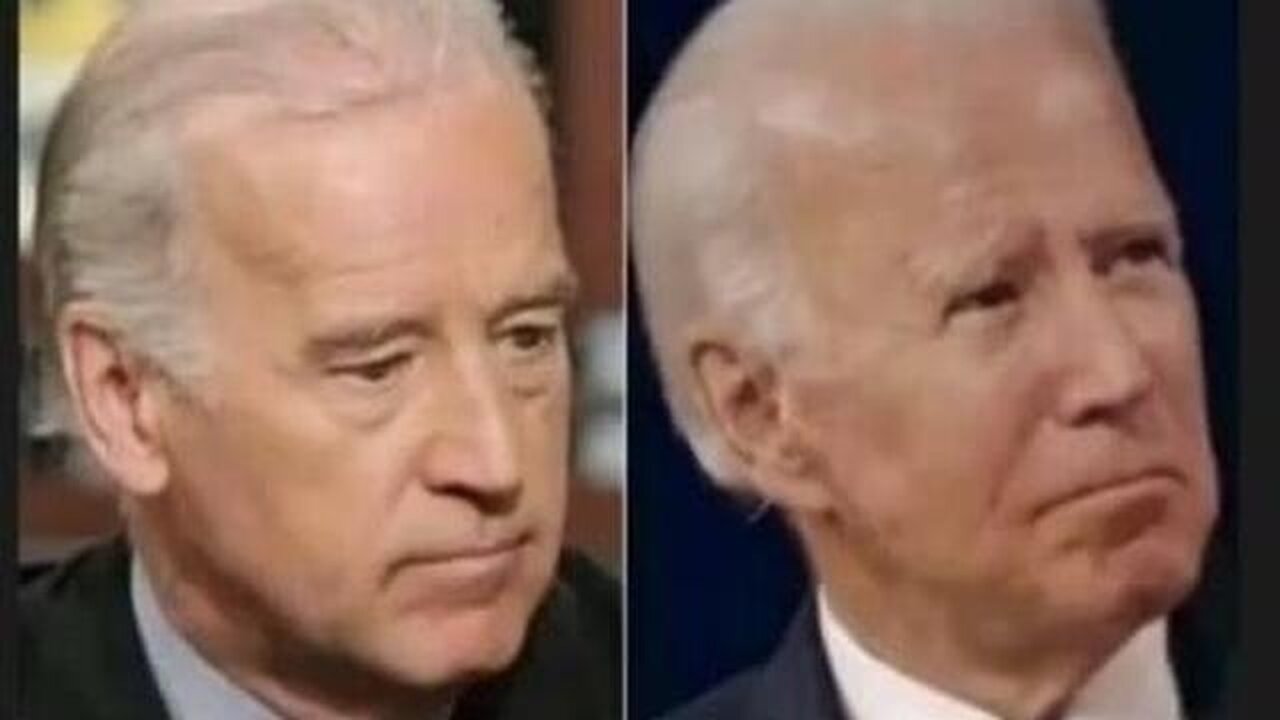 Biden Appears in Public With MASSIVE Mysterious BLACK Bruise On FACE! Elder Abuse? Another Collapse?