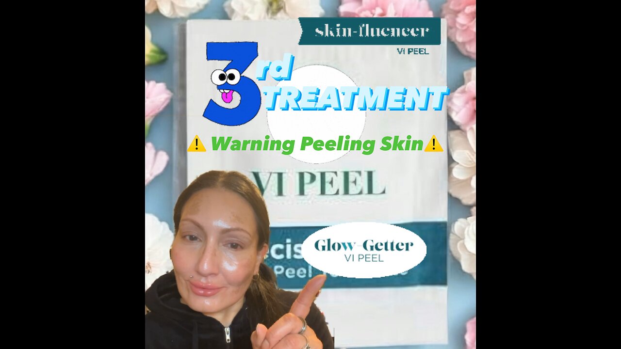 3rd VI Peel Treatment at Fresh Faces Rx