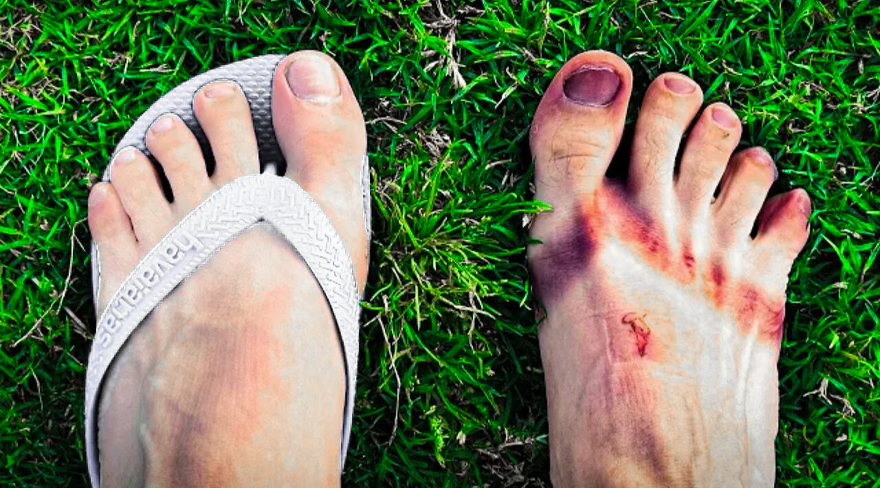 ELE CORREU UMA MARATONA DESCALÇO "OS PÉS NÃO FORAM OS MESMO"