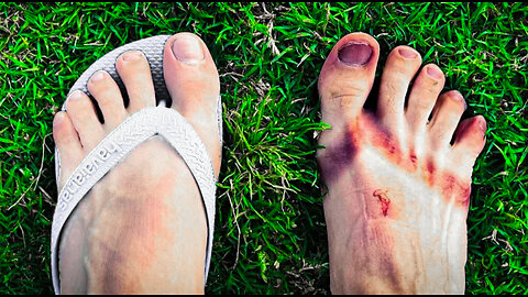ELE CORREU UMA MARATONA DESCALÇO "OS PÉS NÃO FORAM OS MESMO"