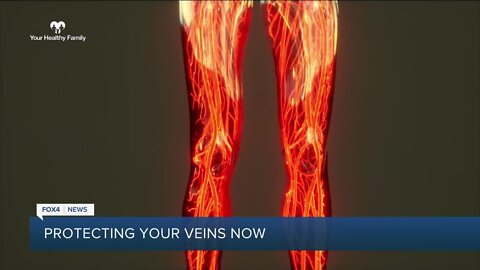 Your Healthy Family: Ways to protect the health of your veins