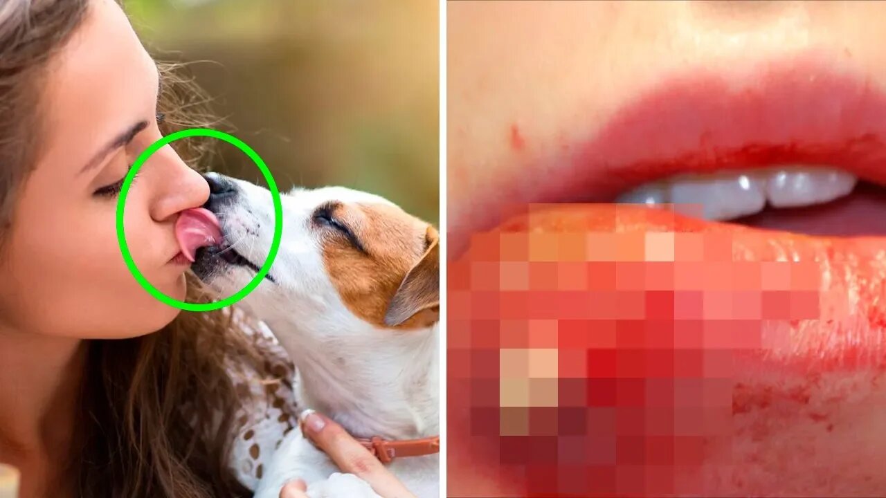 This Is Why You Should Never Let A Dog Lick Your Mouth