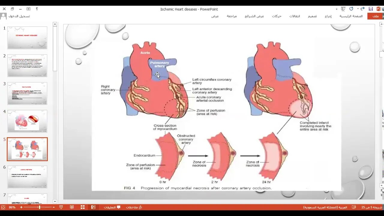 Oral surgery L3 (ischemic heart diseases)