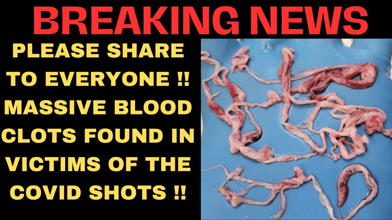 BREAKING NEWS: MASSIVE BLOOD CLOTS FOUND IN VICTIMS OF THE COVID SHOTS !!