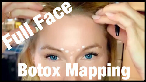 BOTOX MAPPING FULL FACE DIY