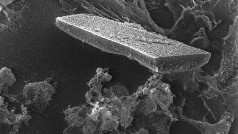 Cholesterol is an Important Molecule (2008) | Raymond Peat