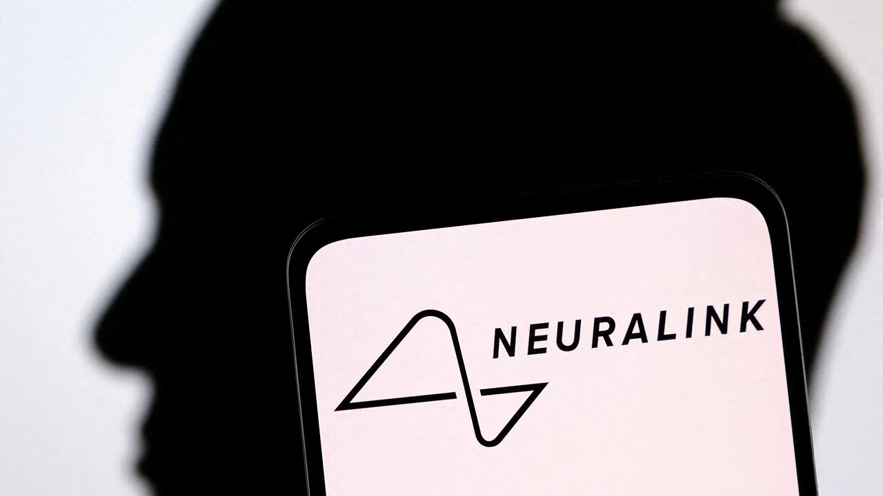 Neuralink, the Image Is Here