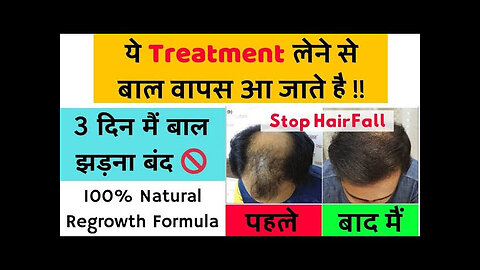 बालो को झड़ने से रोके - Hair regrowth very effective treatment - Hair loss Treatment