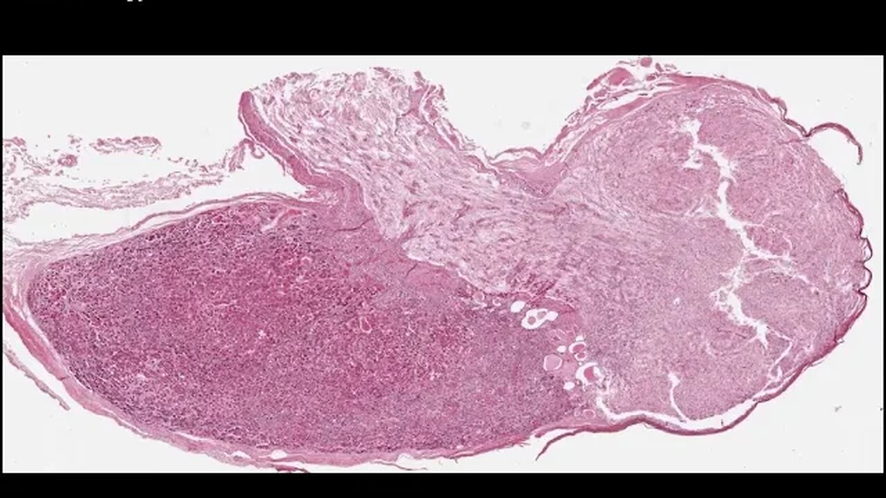 Pituitary and Hypothalamus