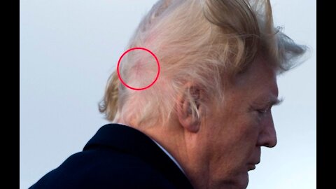 HEADS UP! - Deadly Head Wound coming soon?