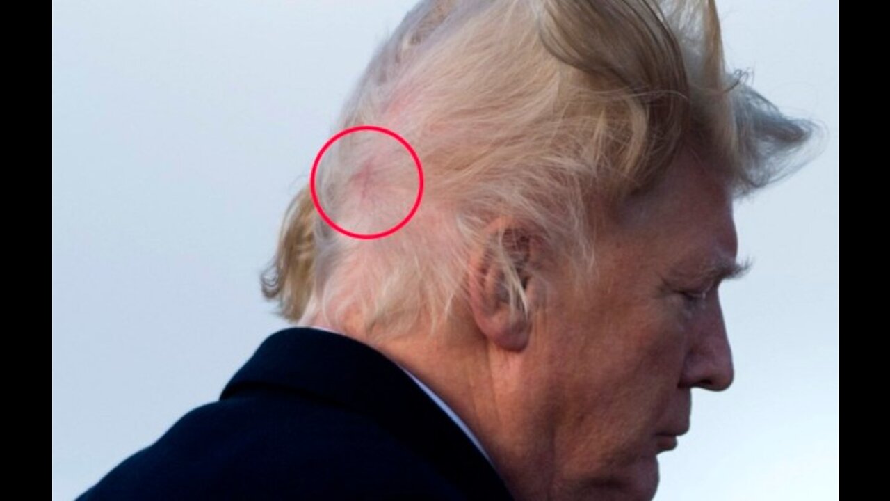 HEADS UP! - Deadly Head Wound coming soon?