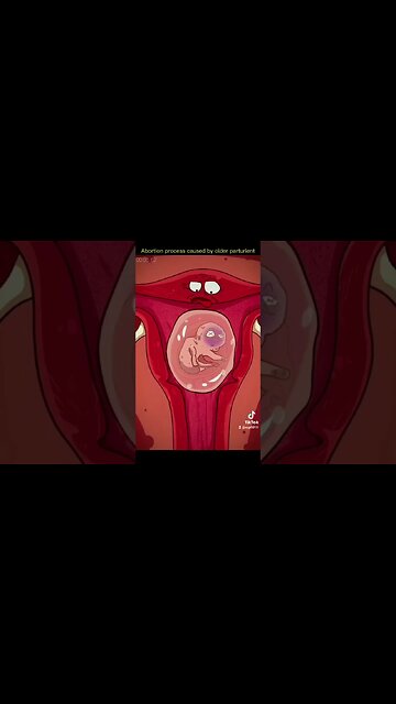 cand candeste a #caras #jmek la ma-ta-n panteque