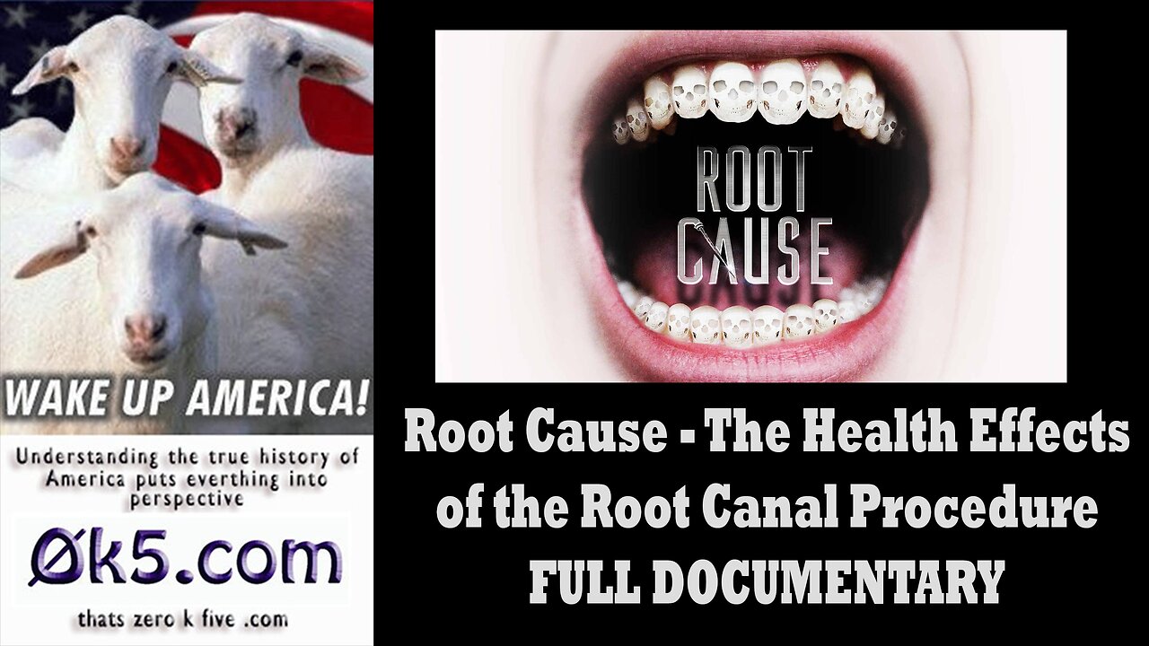 Root Cause - The Health Effects of the Root Canal Procedure - FULL DOCUMENTARY