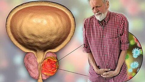 THE REAL CAUSE OF YOUR SWELLING PROSTATE