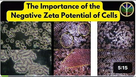 The Importance of the Negative Surface Charge or Zeta Potential of YOUR Blood and Body Cells