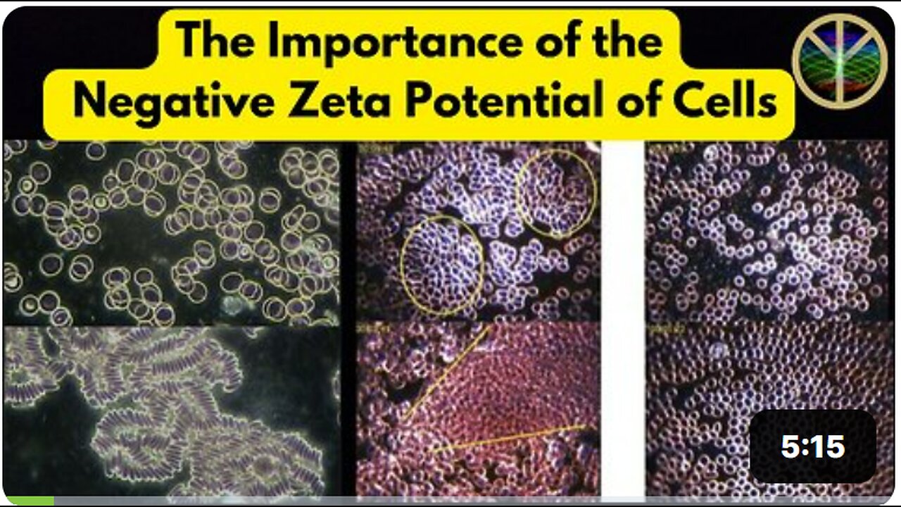 The Importance of the Negative Surface Charge or Zeta Potential of YOUR Blood and Body Cells